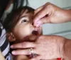 Média de vacinação contra a Poliomielite em Maceió cai e fica 14% abaixo do ideal imagem