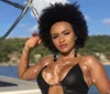 Equipe de Natália denuncia à polícia ataques racistas; foi chamada de 'dálmata' por ter vitiligo imagem