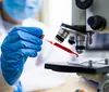Alzheimer: novo exame de sangue tem 97% de precisão no diagnóstico imagem