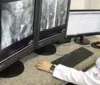 Santa Casa abre inscrições para aperfeiçoamento em tomografia imagem