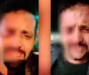 Vídeo: homem é confundido com bandido e perde o olho em briga imagem