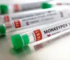 Arapiraca tem mais três casos suspeitos de varíola dos macacos imagem