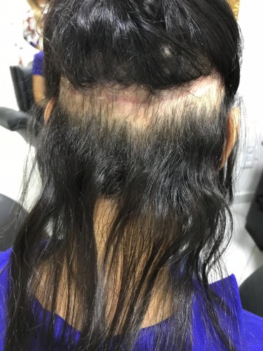 Resultados do procedimento cirúrgico em pacientes