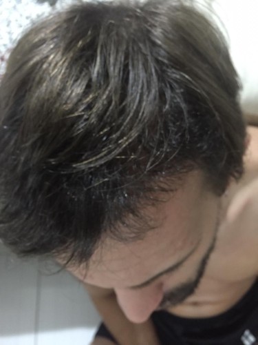 Resultados do procedimento cirúrgico em pacientes
