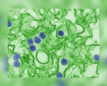 Diagnóstico de zika ainda é limitado e novo teste é urgente, diz especialista