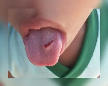 Mãe diz que professora cortou língua de criança como castigo em creche