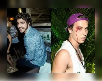 Fotógrafo agredido por Caio Castro vai processar ator e pedir R$ 100 mil