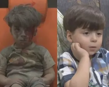 Menino resgatado na Síria cuja imagem comoveu o mundo aparece em reportagem