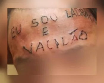 Campanha para remover tatuagem de jovem torturado visa a arrecadar R$ 15 mil
