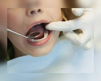 Dentista dá cinco dicas para ter um sorriso bonito e saudável