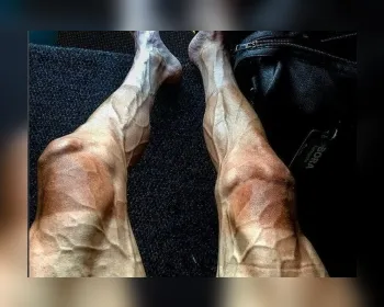 Foto impressionante mostra o impacto do Tour de France nas pernas de um ciclista