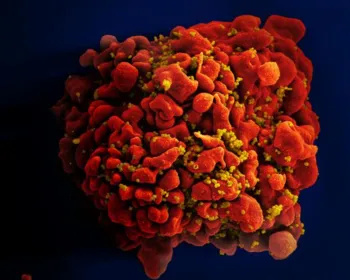 Anticorpo 'três em um' protege macacos contra o HIV, diz estudo