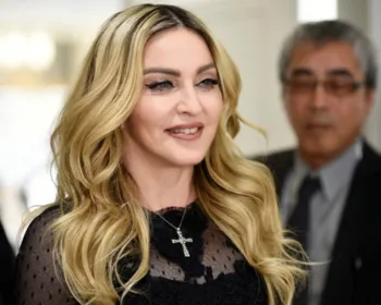 Aos 62 anos, Madonna assume pela primeira vez ser adepta do botox