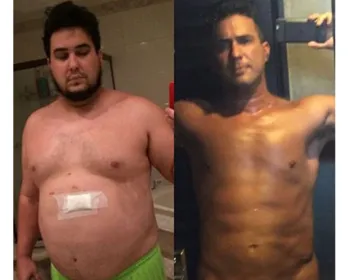 André Marques mostra antes e depois após perder 70 kg: "Luta diária"
