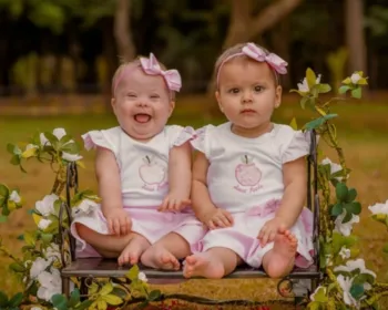 Em caso raro, mãe tem gêmeas e uma delas nasce com Síndrome de Down