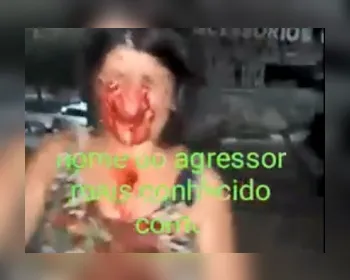 Alagoana é espancada e tem o rosto desfigurado por morador de rua no Ceará