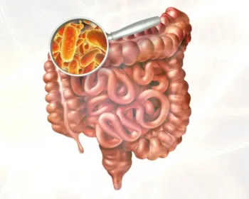 Brasileiros identificam bactérias que facilitam diagnóstico de câncer intestinal