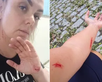 VÍDEO: Ex-paquita é filmada se cortando antes de acusar ex-marido de agressão