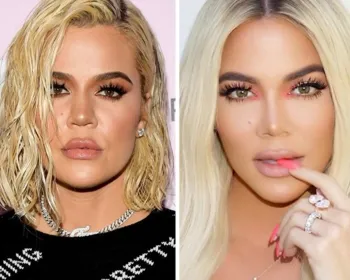 Fãs criticam Khloé Kardashian por suposta plástica: "Cadê seu nariz?"