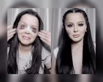 Maraisa mostra antes e depois de make após rinoplastia: "Estou um panda"; vídeo