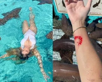 Blogueira é mordida ao nadar com tubarões