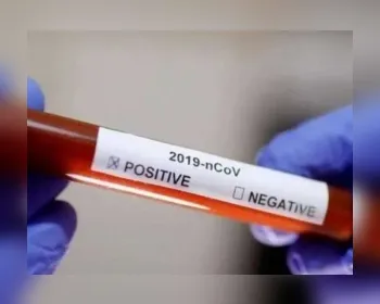 Cientistas estimam que coronavírus já circulava no Brasil no começo de fevereiro