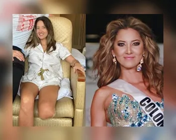 Miss Colômbia 2012 tem perna amputada após complicações em cirurgia de rotina 