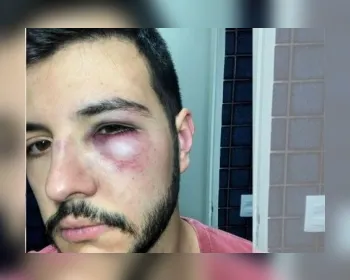 Jornalista Matheus Ribeiro reage a assalto e é agredido em Brasília