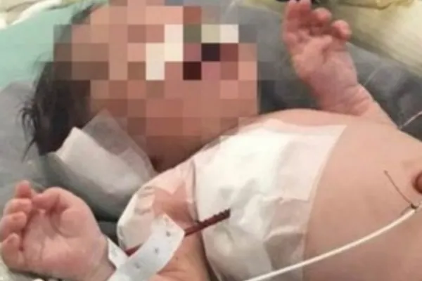 
				
					No Rio, médicos falam de bebê baleado na barriga: 'É guerreiro'
				
				