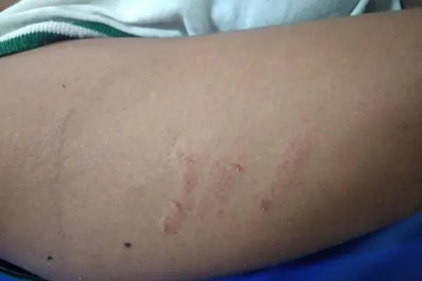 
				
					Menor fica ferida após ser agredida por colegas em escola no Trapiche
				
				