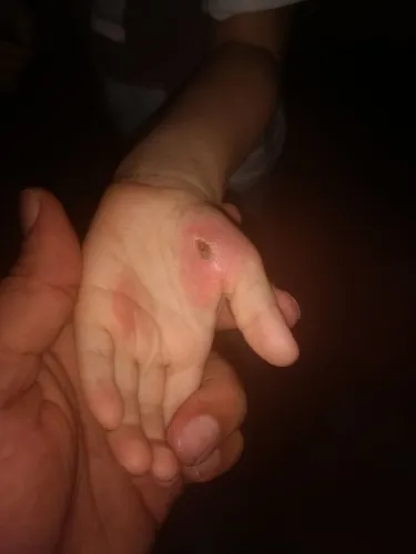 Os cinco menores estavam com queimaduras nas mãos e nos pés
