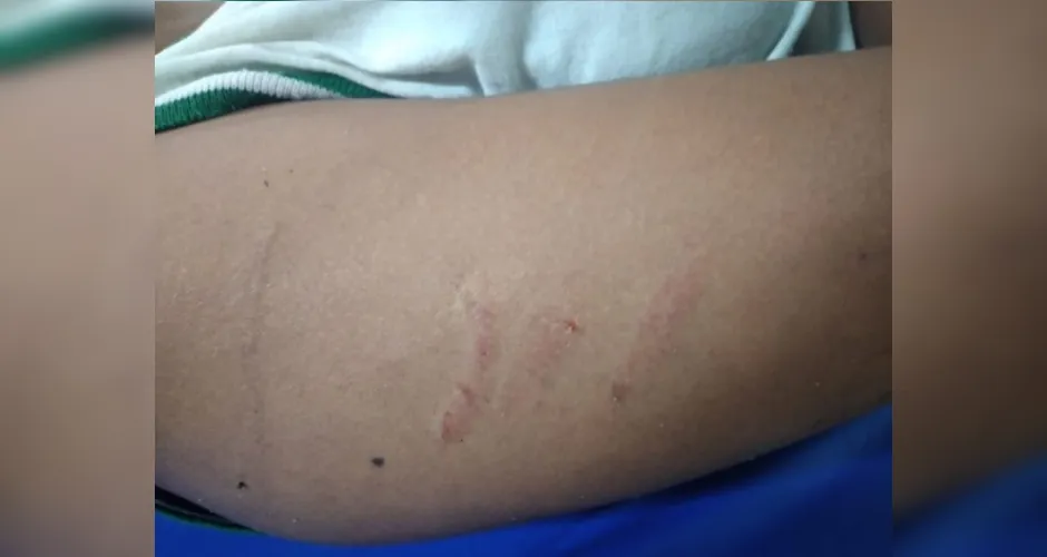 Adolescente ficou ferida durante agressão em escola