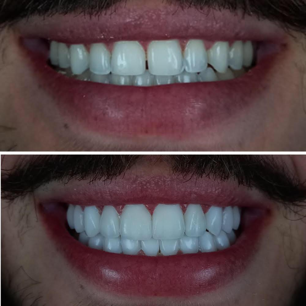 Os dentes do empresário