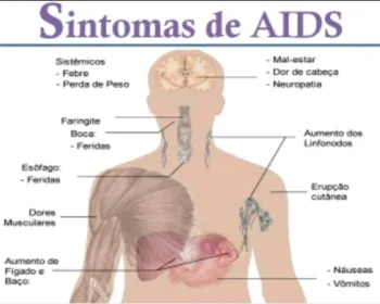 Saiba quais são os principais sintomas da AIDS